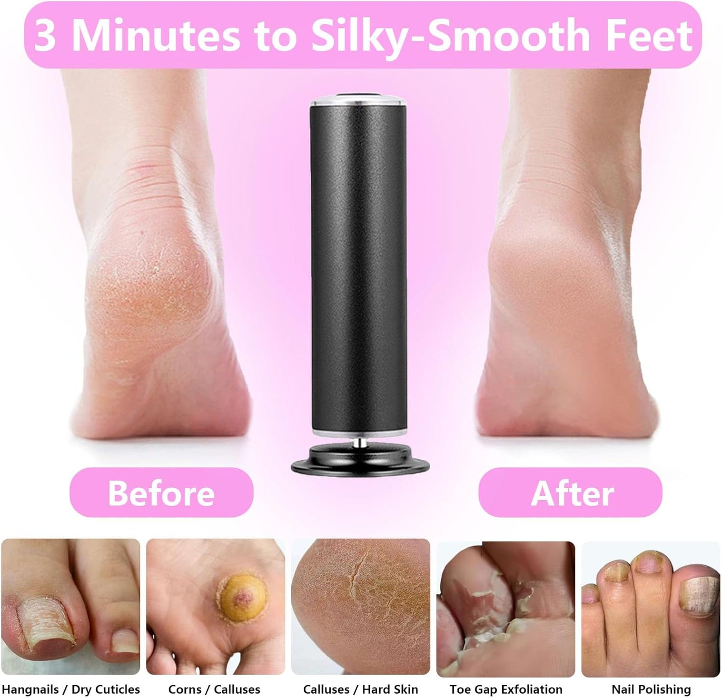 Electric Foot Callus Remover & Sander - 60 Sandpapers, 20 Grinding Heads, Black