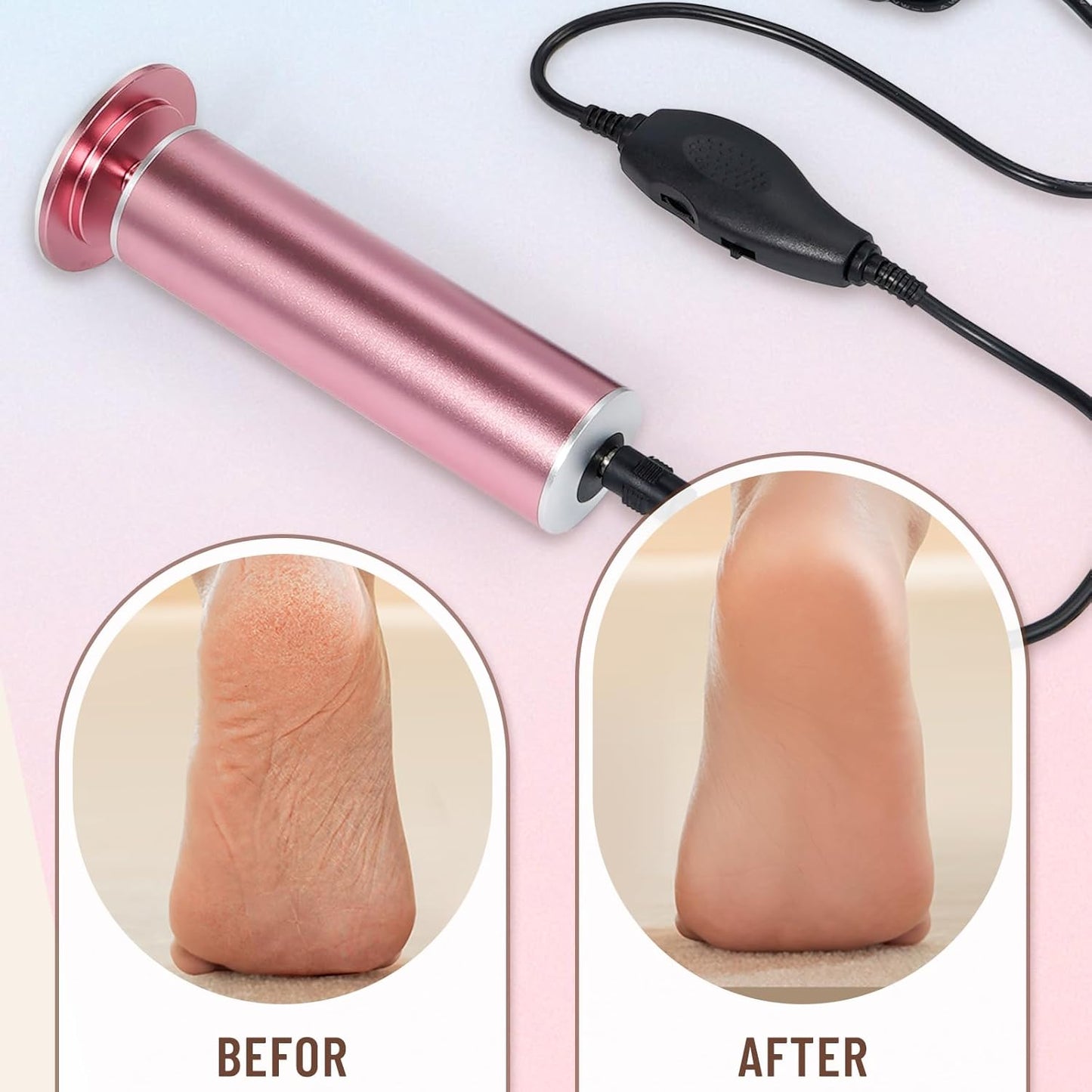 Professional Electric Foot File Callus Remover - Pedicure Tool with 60 Sandpaper Discs for Smooth Feet