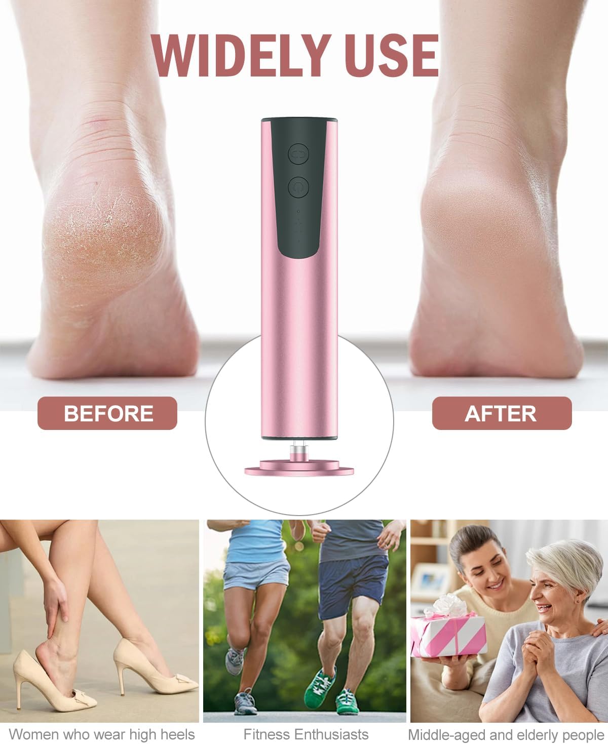 Rechargeable Electric Foot Callus Remover & Nail Drill - 2-in-1 Pedicure Tool for Cracked Feet, 6 Speed