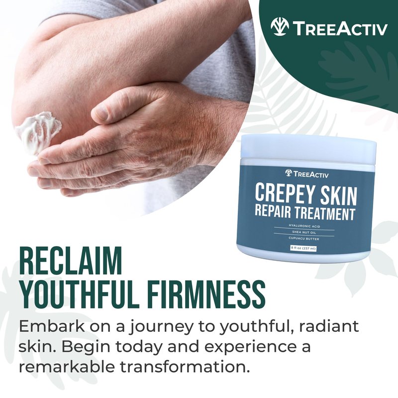 TreeActiv Crepey Skin Repair Cream Original Formula, 8 fl oz, Firming Cream For Face & Neck, Skin Firming Lotion with Hyaluronic Acid, Crepey to Address Dry Crepe