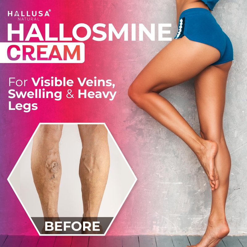 Hallusa Natural Hallosmine Leg Cream with Diosmin, Hesperidin, Horse Chestnut, Menthol & Aloe Vera | Daily Leg Comfort for Visible Veins, Swollen Feet, Ankles and Legs, 4oz (112g)