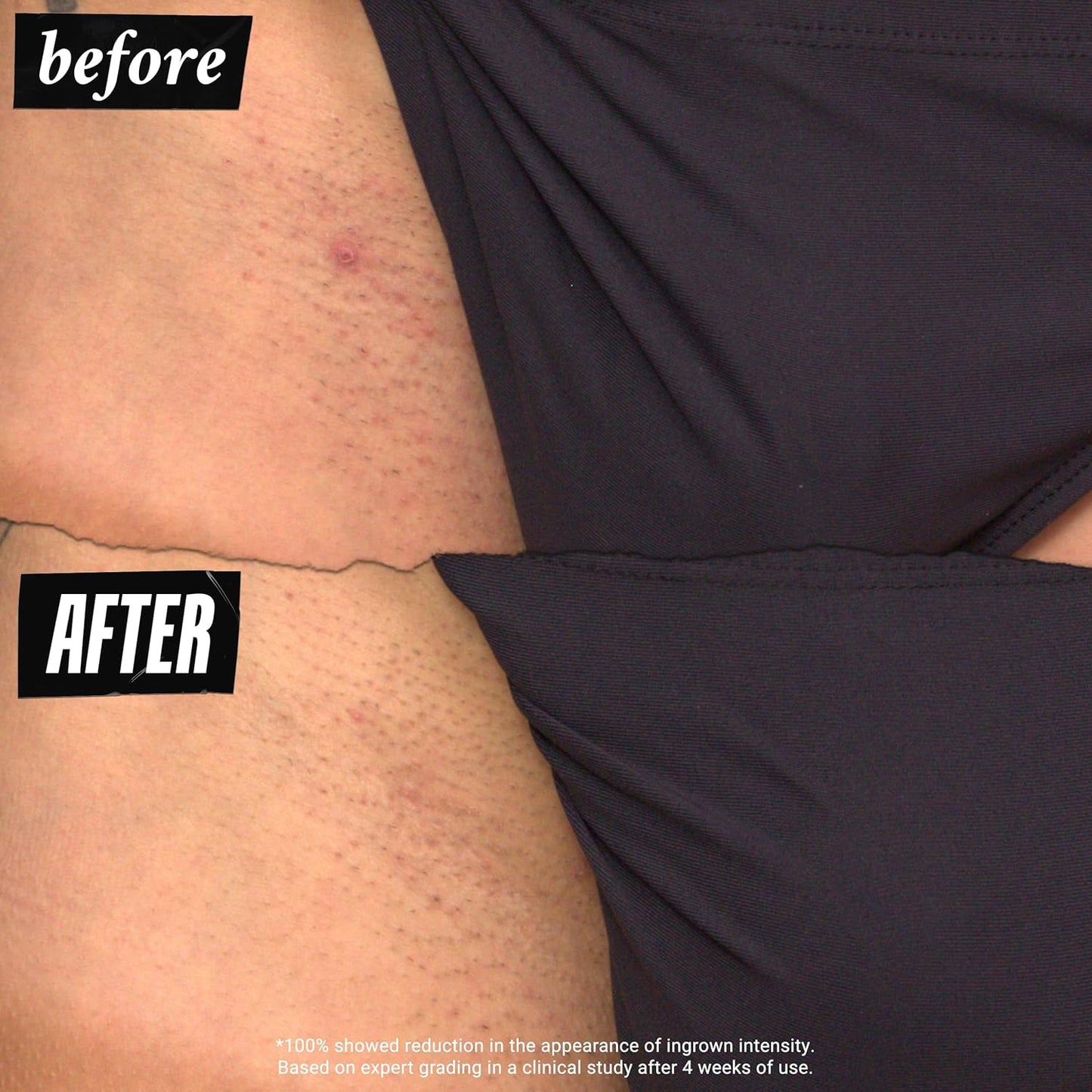 Kiehl's Ingrown Hair & Tone Correcting Drops - 30ml | Smooth Skin Solution