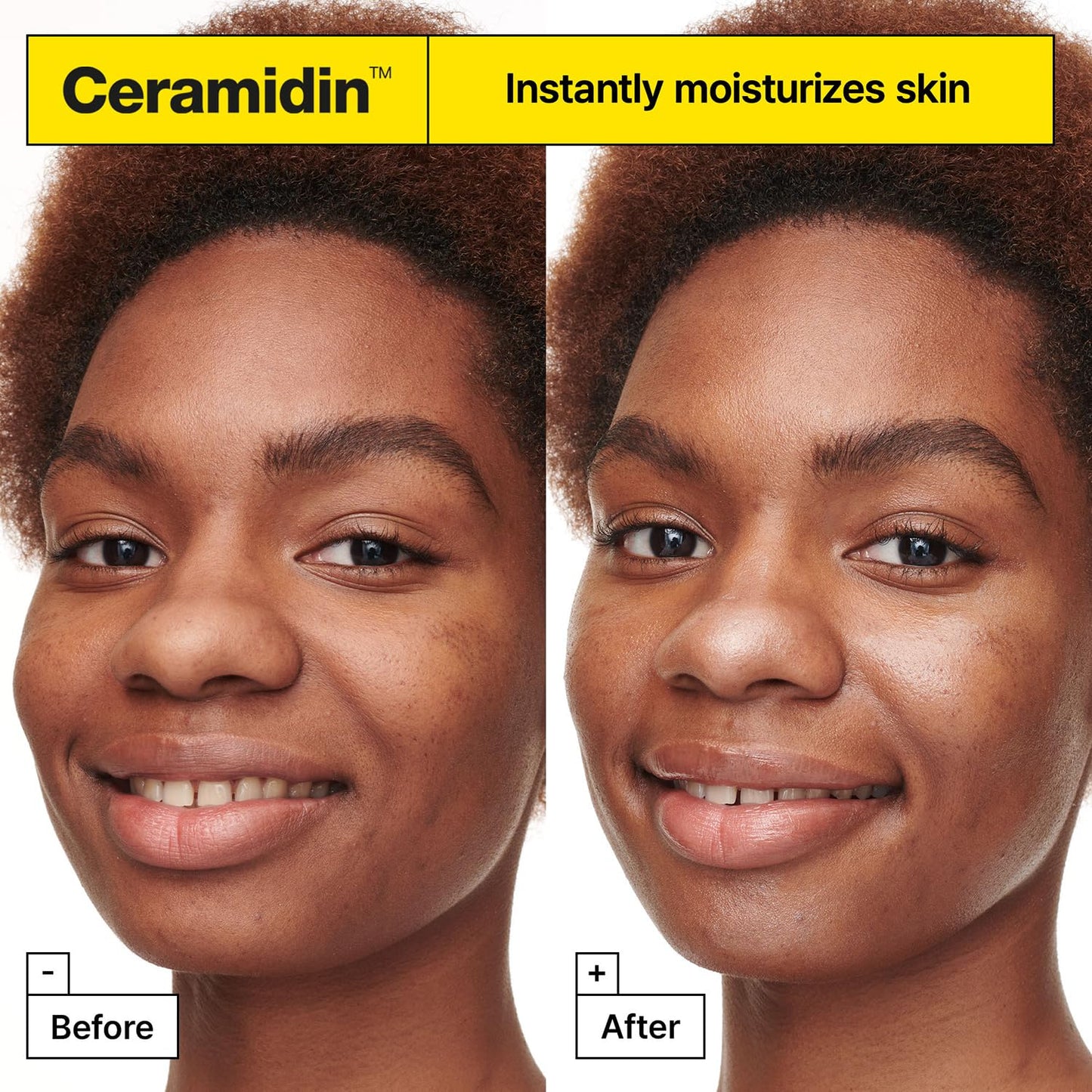 Dr.Jart+ Ceramidin Moisture Treats Korean Skin Care Ornament Gift Set, Travel Size Ceramide Face Moisturizer and Full Size Lip Balm for Hydration and Skin Barrier Repair, Limited Edition Holiday Set