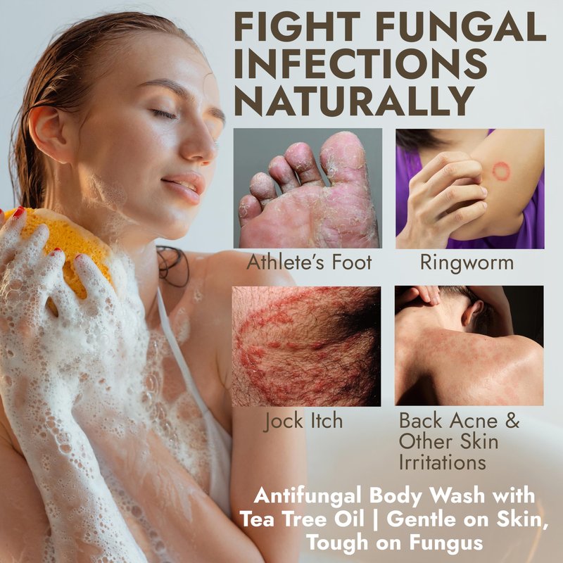 Antifungal Body Wash with Tea Tree Oil | Antifungal Soap for Back Acne,Treats Ringworm, Eczema & Jock Itch | Antifungal Body Soap For Men And Women | Includes Silicon Scrubber (16.9 oz)