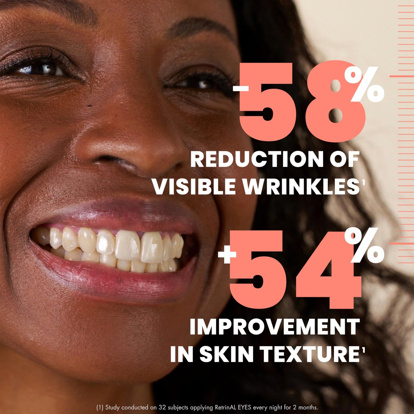 Avene RetrinAL 0.1 Intensive Cream, Retinaldehyde, Reduce Signs of Aging, Brighten & Rejuvenate Skin, 1.01 Oz