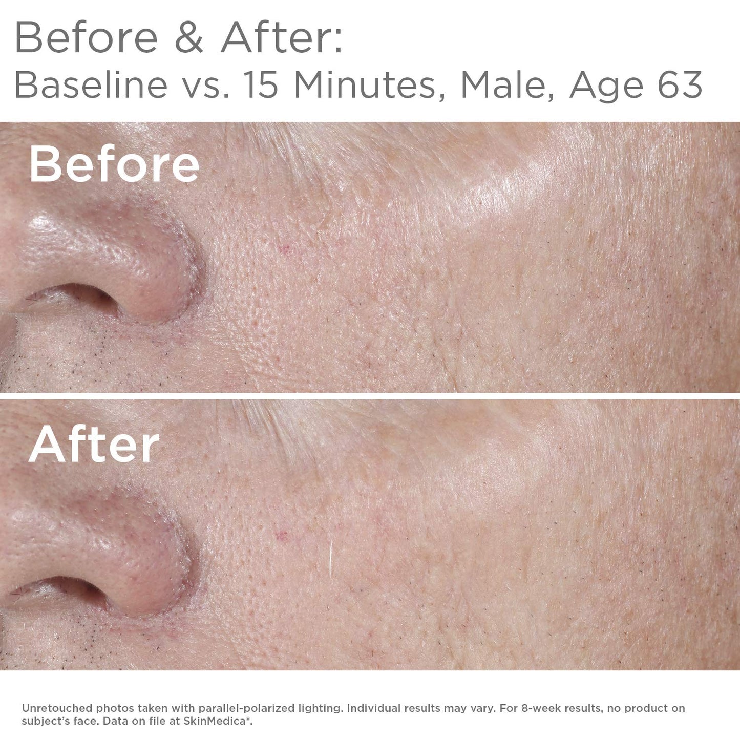 SkinMedica HA5 Rejuvenating Hydrator 1.0 oz.