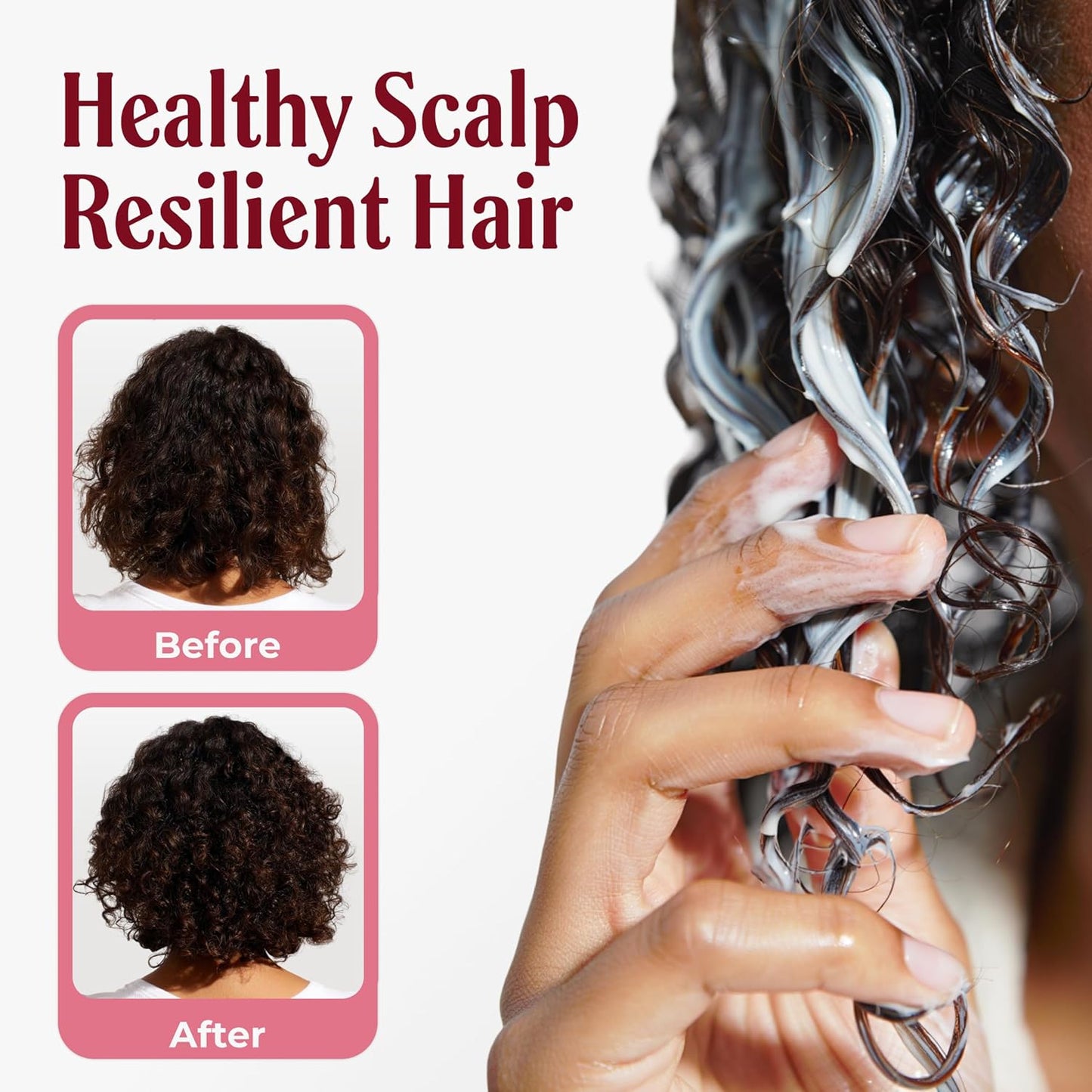 Onion Hair Treatment - Deep Repair & Hair Loss Control | Argan & Aloe Infusion | 16.9 fl oz
