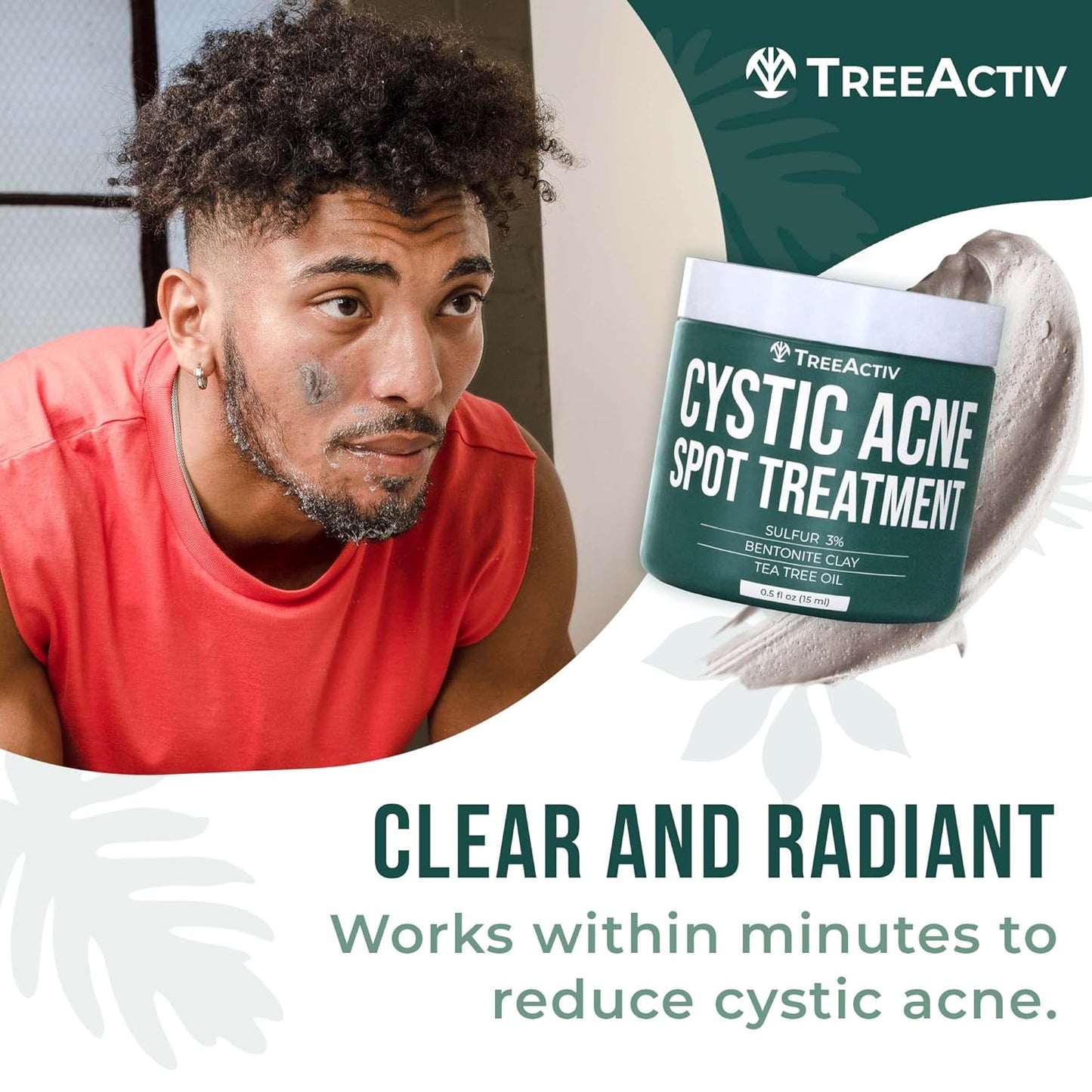 Cystic Acne Spot Treatment Paste - Sulfur & Tea Tree Oil | 0.5 oz for Deep Breakouts