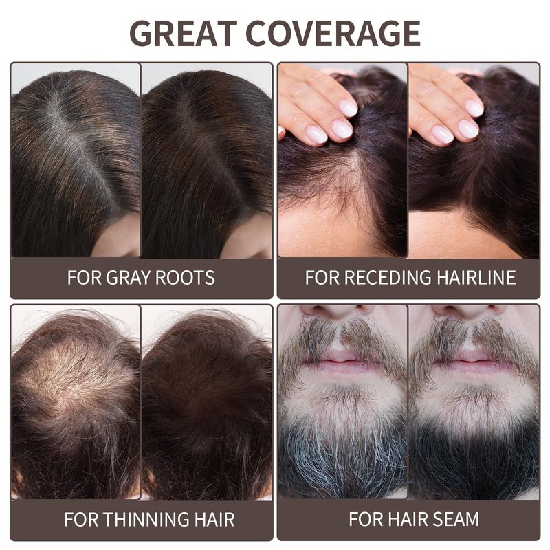 Waverloo Magic Root Cover Up Instantly Conceals High Forehead & Hair Loss - Sweat & Waterproof Root Touch Up Hair Powder for Women & Men (Dark Brown, 4g)