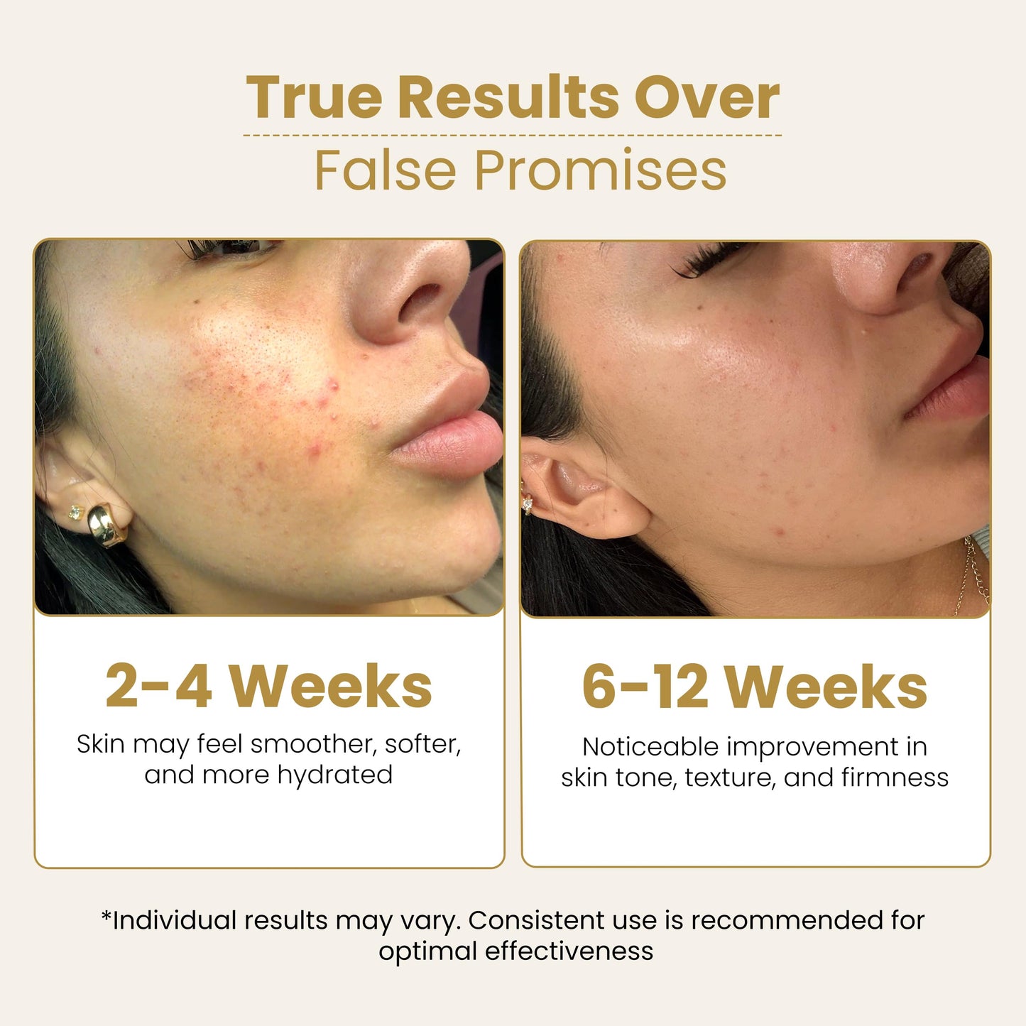 Mayam Beauty Vitamin C Serum for Face, C+E FERUGLOW Brightening Face Serum with 15% Vitamin C, Vitamin E & Ferulic Acid, Dark Spot & Radiance Serum – 50ml