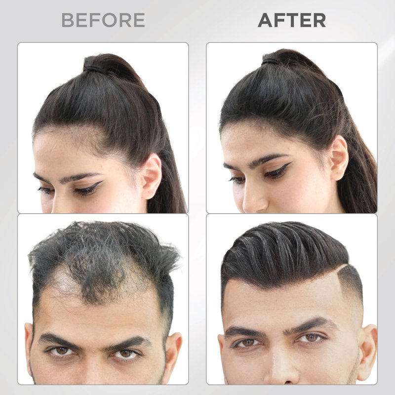THICK FIBER Hair Fibers for Thinning Hair & Bald spots (BLACK, Pack of 2) - 25g Bottle - Conceals Hair Loss in Seconds - Hair Powder For Women & Men