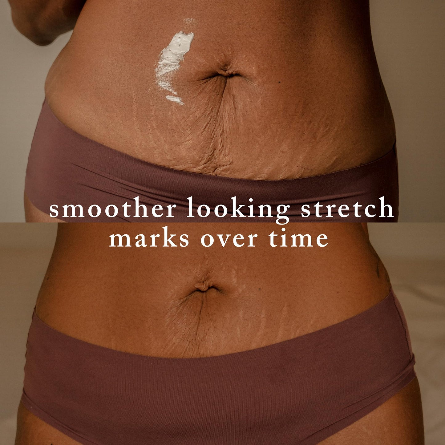 Nemah - Stretch Mark Cream for Pregnancy - Pregnancy Stretch Mark Prevention & Reduction