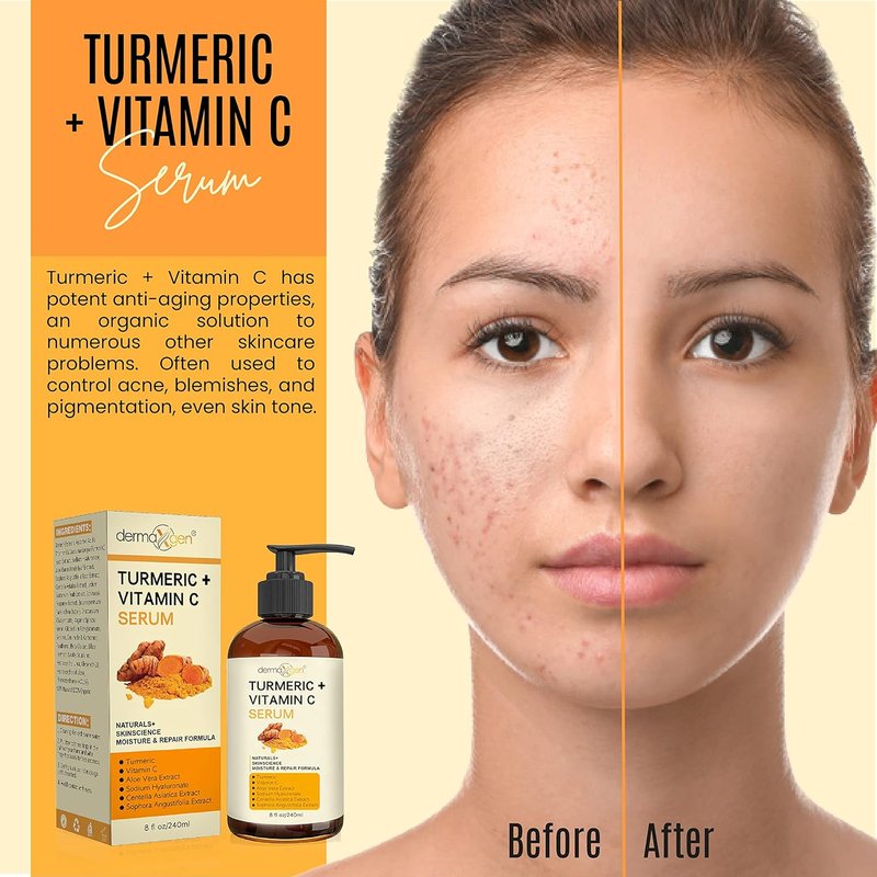 Turmeric Serum for Face | Glow-Boosting Vitamin C Moisturizer - Organic Anti-Aging Formula for Dark Spots & Wrinkles - 8 FL OZ