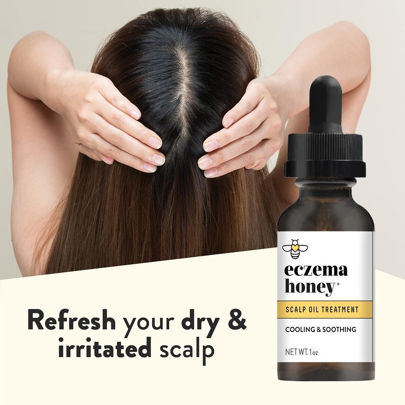 Eczema Honey Soothing Scalp & Hair Oil - Natural Relief Serum for Dry Itchy Scalp | 1 Oz Treatment for Psoriasis & Dandruff