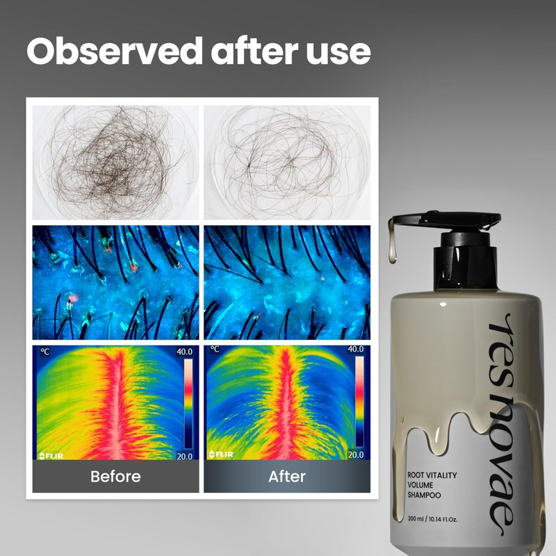 res novae Root Vitality Volume Shampoo 100ml, Scalp Balancing & Volumizing Hair Shampoo with Peptides, Amino Acids & Botanical Extracts