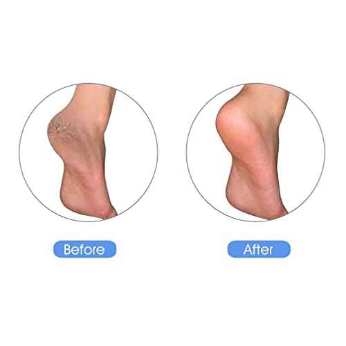 Pumice Stone for Feet, Natural Earth Lava Pumice Stone - Foot Callus Remover for Feet Heels, Pedicure Exfoliator for Dead Skin, Hard Skin and Foot Scrubber