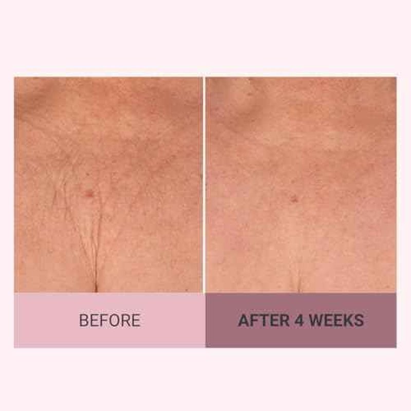 Consult Beaute Champagne Lift Hydrating Firming Body Cream with Pink Pepperslim for Crepey Skin Moisturizer Tightens, Tones & Hydrates Dry Skin on Arms & Legs - 8 oz.