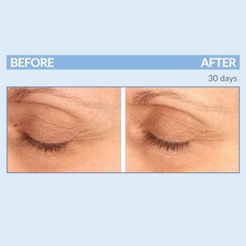 Serious Skincare - Eyetality PM Eye Night Cream with Resveratrol - Keratin & Lash Boosting Peptides for Thicker, Longer Lashes - Antioxidant-Rich to Treat Under Eye Signs of Aging 0.5 FL.Oz.