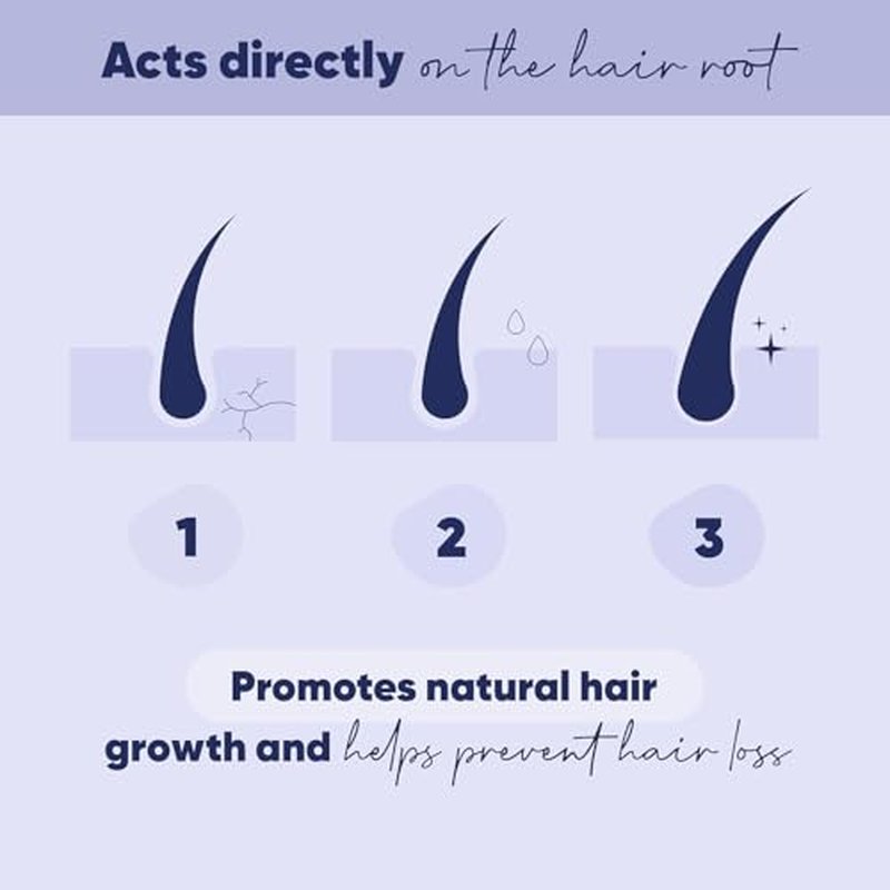 MOERIE Ultimate Hair Growth Serum for Natural Hair Regrowth & Thickening - Anti Thinning & Hair Loss Treatment for Women - Rapid Hair Growth Products (1.69 Fl Oz (Pack of 3))