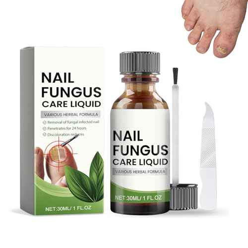 Nail Growth Serum Nail Care - Nail Repair for Damaged Toenails and Fingernails, Toenails Renewal Liquid for Thick, Damaged, Yellow, Ingrown Nails (30ml)