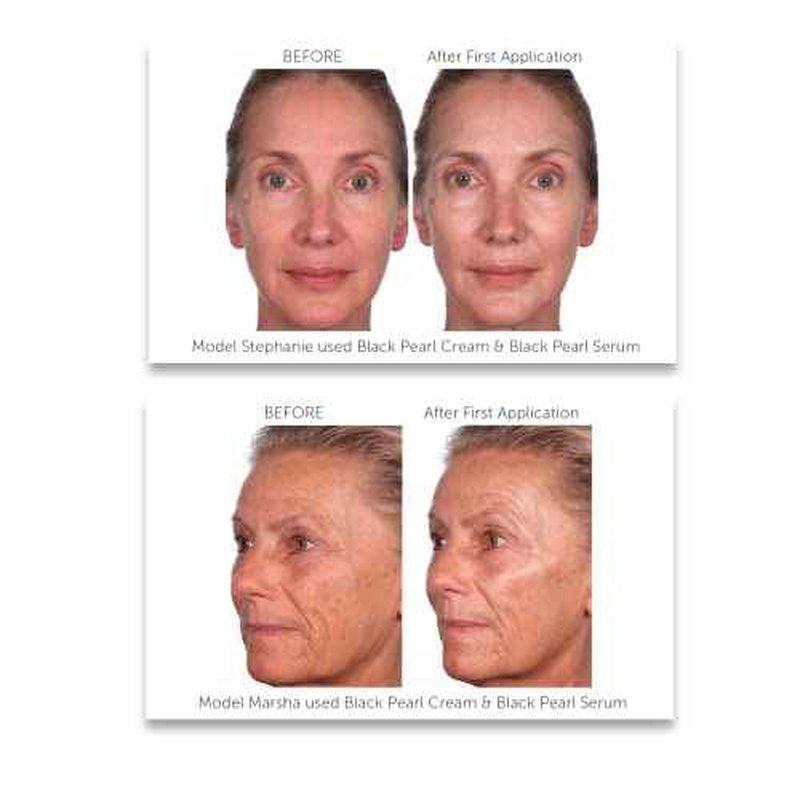 Serious Skincare - Black Pearl Deep Wrinkle Decrease Face Serum - Repair Deep Lines & Wrinkles - Increases Skin Hydration & Elasticity - Radiance Boosting for Luminous Glowing Skin 1 Fl. Oz.