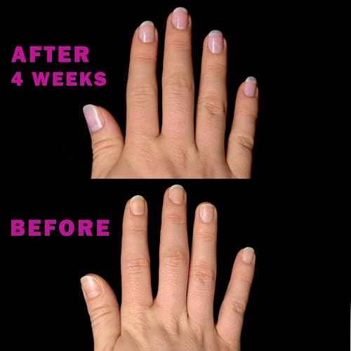 Perfect Formula Pink Gel Coat - Nail Strengthener and Strengthening Polish for Women, Extra Strong Nail Hardener, Keratin Treatment for Damaged Fingernails
