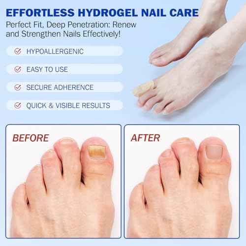Fungal Nail Patches for Toenails, 42pcs/box Nail Health Care Patches, Overnight Toe Nail Treatments for Damaged Nails Foot Nails Repair and Care (2)