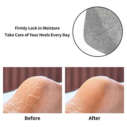 tifanso 3 Pairs Moisturizing Heel Socks for Dry Cracked Feet, Gel Repair Moisture Spa Socks for Women Dry Cracked Heels Overnight (Regular)