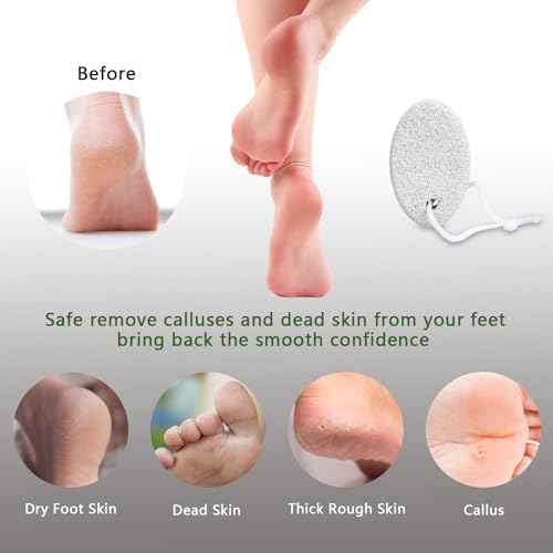 Natural Foot Pumice Stone for Feet, Borogo 2-Pack Lava Pedicure Tools Hard Skin Callus Remover for Feet and Hands - White&Red