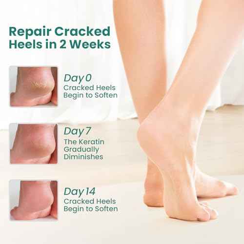 Welnove Moisturizing Heel Socks - 2 Pairs Aloe Vera Extract Infused Gel Lining for Dry Feet - Cracked Heel Repair Treatment - Cotton Socks for Women Men Foot Care (Regular Sizes)