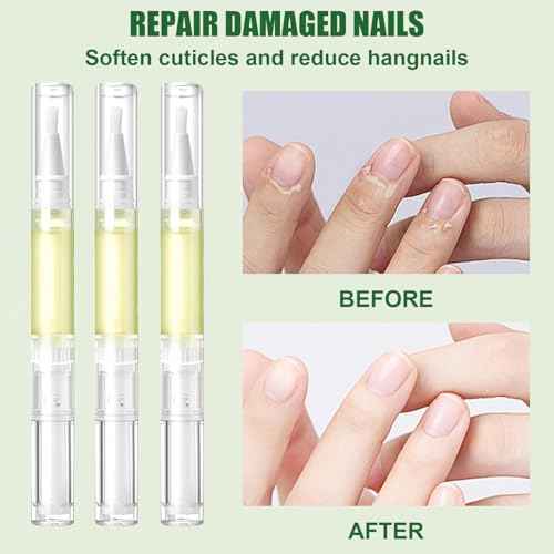 Nail Growth Oil,Radiant Nail Growth Oil Pen,NailOil For Growth And Strength Rejuvenation for Moisturize Strengthen Nail Care (3Pcs)