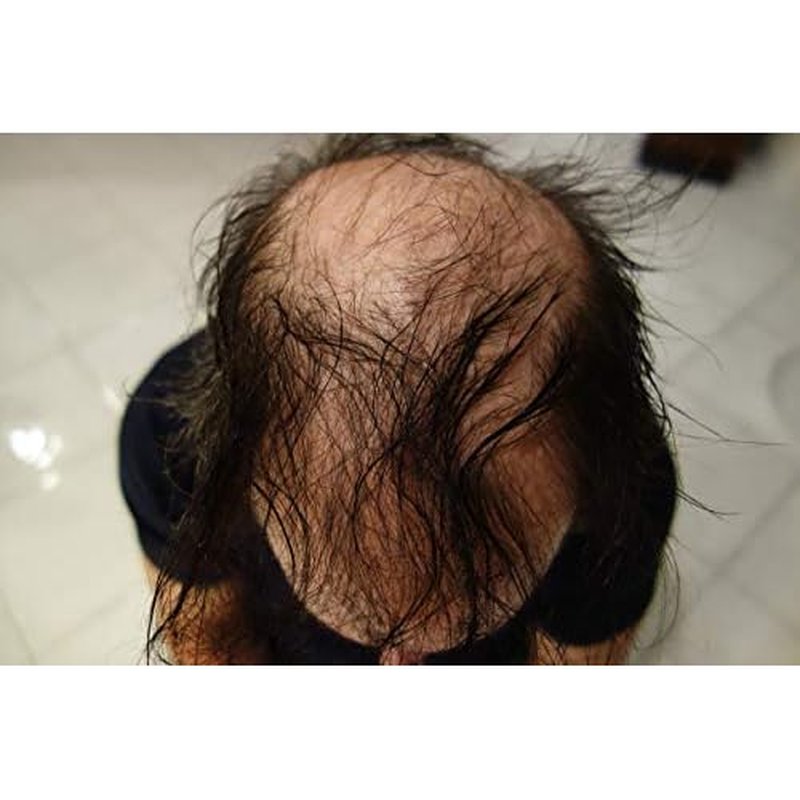 Hair Building Fibers 200 Grams 7 Oz. With Bottle By Finally Hair 50g*4 (Black)