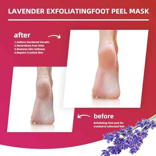 Foot Peel Mask for Dry, Rough Feet ? Exfoliating Foot Mask with Fruit Acids, Lavender & Urea ? Peeling Socks for Dead Skin & Cracked Heels ? Foot Care for Women & Men
