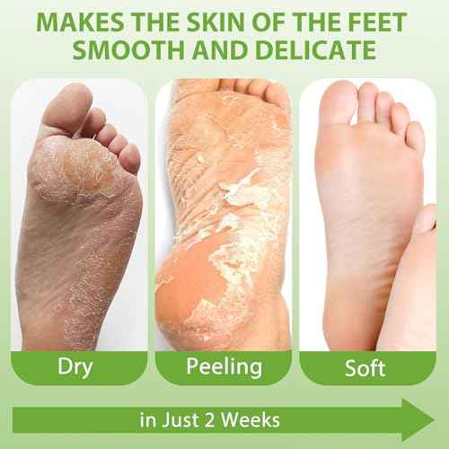 4 Pack Foot Peel Mask, Aloe Vera Hydrating Foot Mask, Deep Exfoliation for Smooth Feet, Foot Mask for Removes Dead Skin and Calluses, Nourishing Formula with Soothing Aloe
