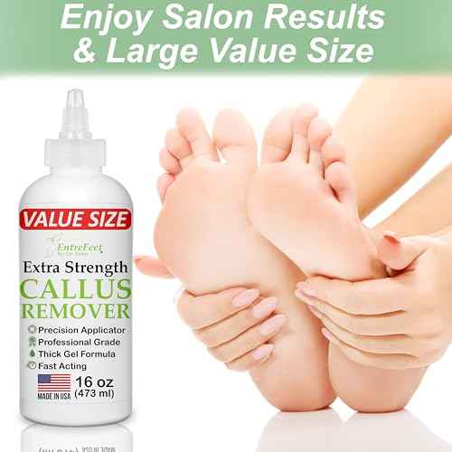 Dr. Entre's 16oz Callus Remover Gel: Extra Strength Value Size, Callus Remover for Feet, Pedicure Tools Supplies, Dead Skin Remover, Foot Care
