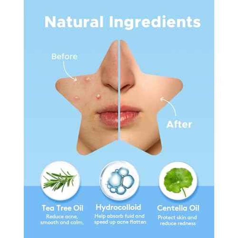 LitBear Acne Patch Pimple Patch, 6 Colors 240 Dots Star Pimple Patches with Tea Tree Oil & Centella Oil, Hydrocolloid Acne Pimple Patches for Face Cute Zit Patches Pimple Stickers Acne Dots