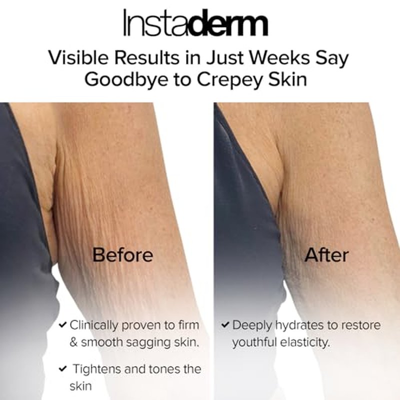 Crepe Fix Body Restorative Cream ? Anti-Aging Wrinkle Cream, Support Skins Natural Elastin & Collagen Production to Restore, Lift, Tighten, Hydrate & Smooth Thinning Aged Crepey Skin. 8OZ