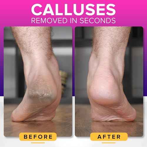 RUSTPROOF Foot File Callus Remover for Feet with Skin Catcher (XL Size) NYK1 MEGAFILE Foot Callus Remover for Wet & Dry Use - High-Performance Feet Scrubber with Textured Grip for Non-Slip Control