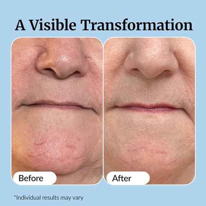 Vibriance Super C Serum for Mature Skin - All-in-One Vitamin Formula Hydrates, Firms, Lifts, Smooths, Targets Age Spots, Wrinkles, 1 fl oz - Pack of 3