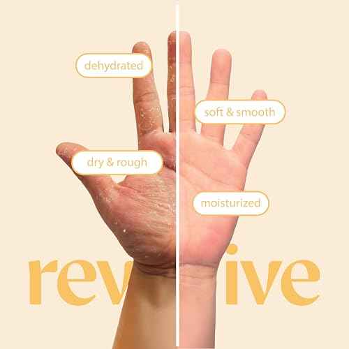 Innerest 12 Pairs Original Derma Beauty Hand Mask Bulk, Moisturizing Hand Gloves for Dry Hands, Nail Care Essential (Vitamin E)