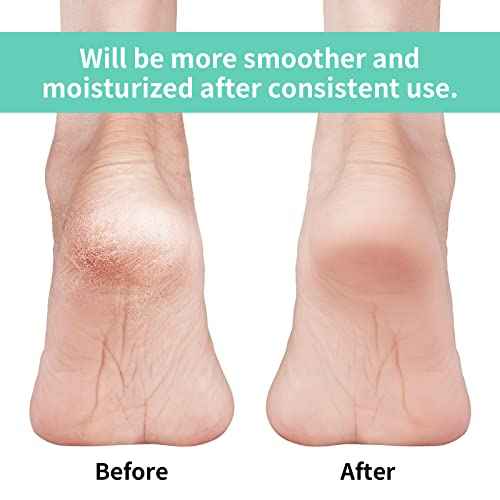 Vaincre Gel Moisturizing Heel Socks for Dry Cracked Feet Women, 4 Pairs Foot Care Spa Moisture Toeless Socks for Cracked Heel Repair Treatment Overnight (Regular)