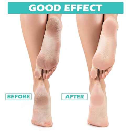 Tarpop 3 Pairs Aloe Socks Women Moisturizing Spa Socks for Dry Cracked Heel Feet Infused Gel Sleeping Fuzzy Lotion Valentines Day Gift for Women Men Softening Dry Feet(White, Green, Colorful)