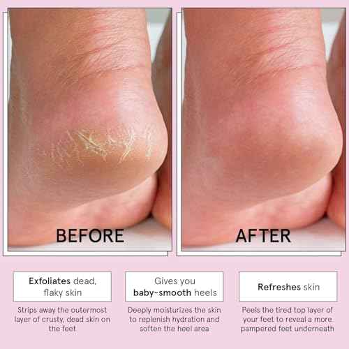 grace & stella Award-Winning Foot Peeling Mask - Foot Peel Masks with Aloe Vera- Moisturizing Foot Masks That Remove Dead Skin, Exfoliating Foot Mask for Dry Cracked Feet (4 Pairs, Unscented)
