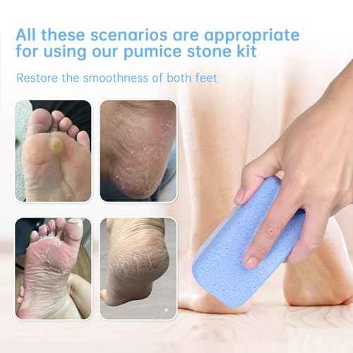 Glass Pumice Stone for Feet Callus Remover?4-in-1 Foot Scrubber Kit with 2 Bigger Dual-Sided Foot Pumice Stones, Cone Foot Exfoliator, Nail Brush for Cleaning Fingernails ?Blue &White