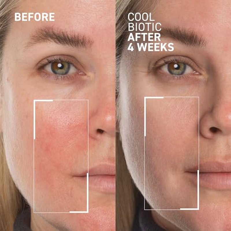 Dr. Brandt Cool Biotic - Prebiotic Redness Relief Cream - Cools on Contact to Soothe Dry, Itchy, and/or Sensitive Skin - 1.7 oz