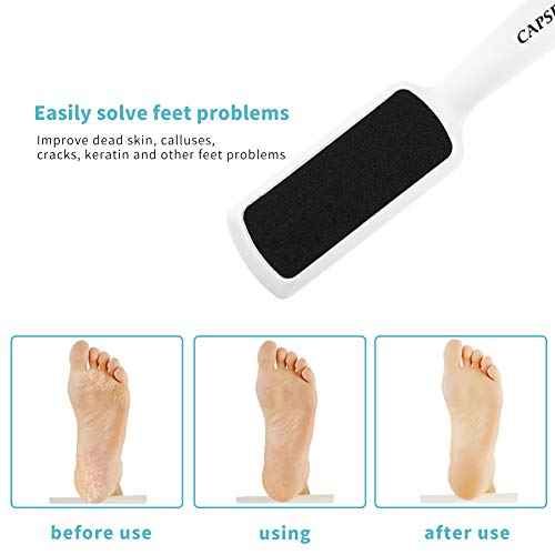 Pedicure Foot Rasp File Callus Remover, Double-Sided Colossal Foot Rasp Foot File And Callus Remover For Dead Skin (Pack of 4)