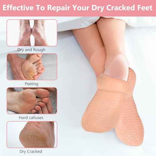 Silicone Moisturizing Socks for Dry Cracked Feet - 2 Pairs, XL Long Size, Non-Slip Heel Socks for Women and Men - High Stretch Foot Care Pedicure - White & Beige