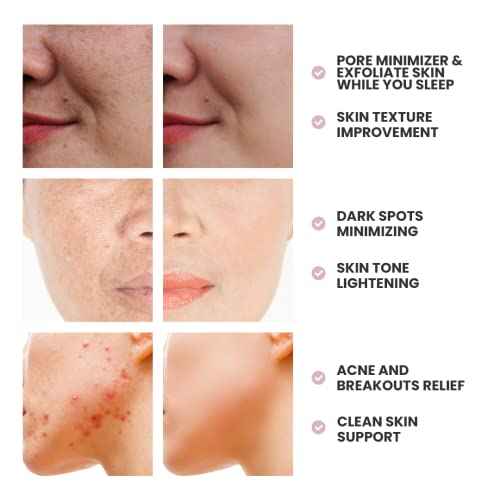 Skin Deva Glycolic Acid Cream Exfoliates Skin During Sleep - Brightens, Corrects Dark Spots & Shadows, Evens Skin Tone, Reduces Pores. Natural Glycolic, Kojic, Salicylic Acid, Niacinamide, Retinol, Arbutin