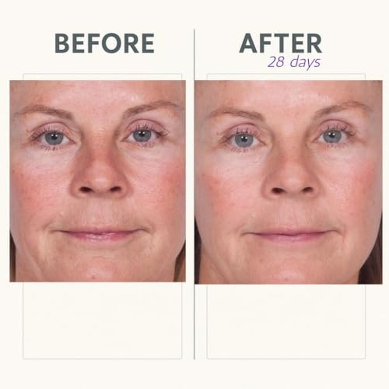 Reverse Lift Firming Facial Serum, Visibly Firm, Tone & Tighten Skin, Hydrating Anti-Aging Peptides, Reduce Wrinkles, Sagging Face and Neck, Serious Skincare, 1 oz