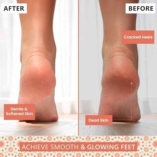 Natural Terracotta Pumice Stone for Feet ? Handcrafted Foot Scrubber & Callus Remover with Gentle Exfoliation and Ergonomic Design for Smooth, Soft & Refreshed Feet ? for a Spa-Like Pedicure